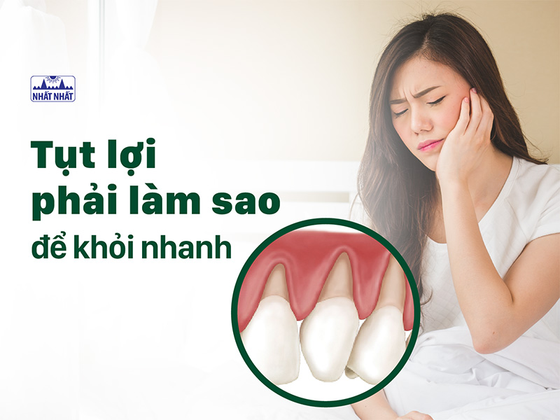 Tụt lợi phải làm sao