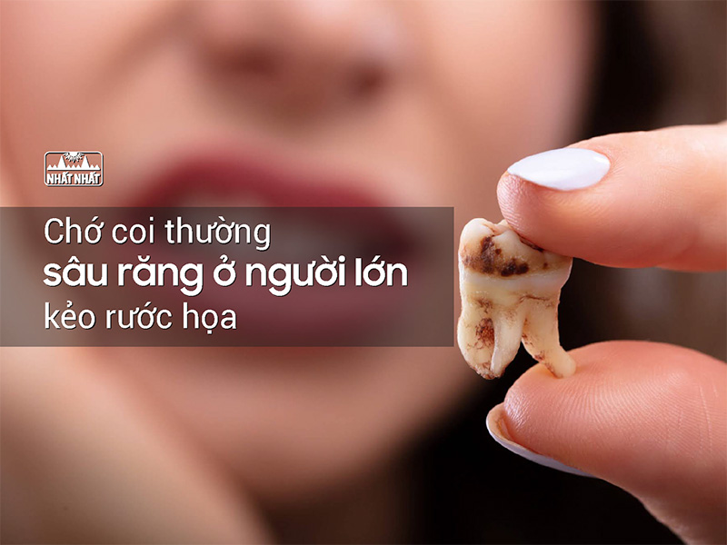 Sâu răng ở người lớn