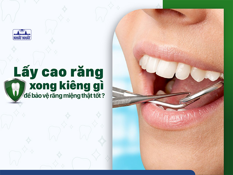 lấy cao răng xong kiêng gì