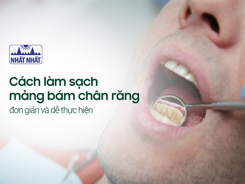 làm sạch mảng bám chân răng