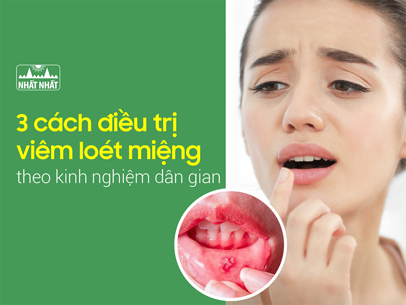 điều trị viêm loét miệng