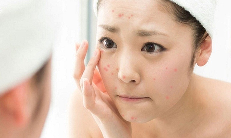 cách rửa mặt sạch