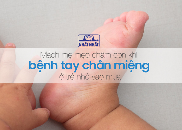 bệnh tay chân miệng