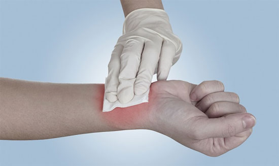 Sát trùng vết thương là bước rất quan trọng