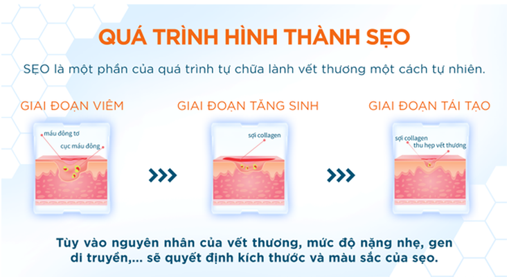 Sẹo có thể xảy ra khi có tổn thương ở lớp hạ bì