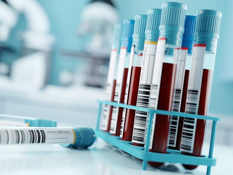 sốt xuất huyết bệnh học