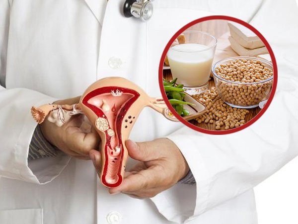 khối u xơ tử cung