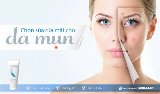 sữa rửa mặt cho da mụn