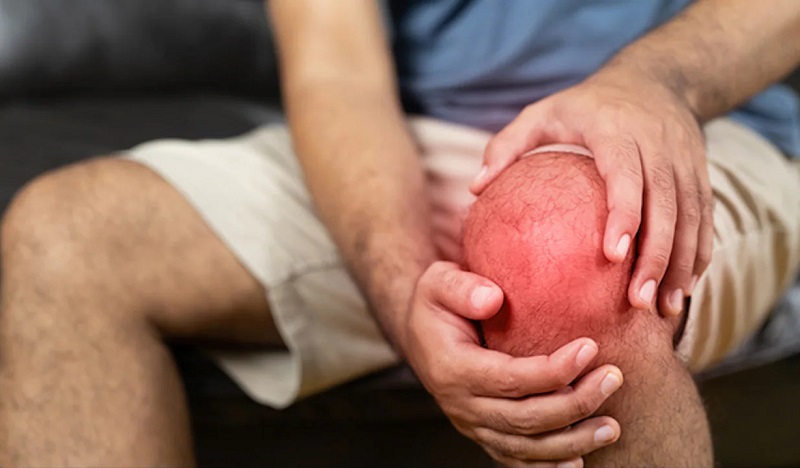 Sưng là triệu chứng điển hình của tràn dịch khớp?