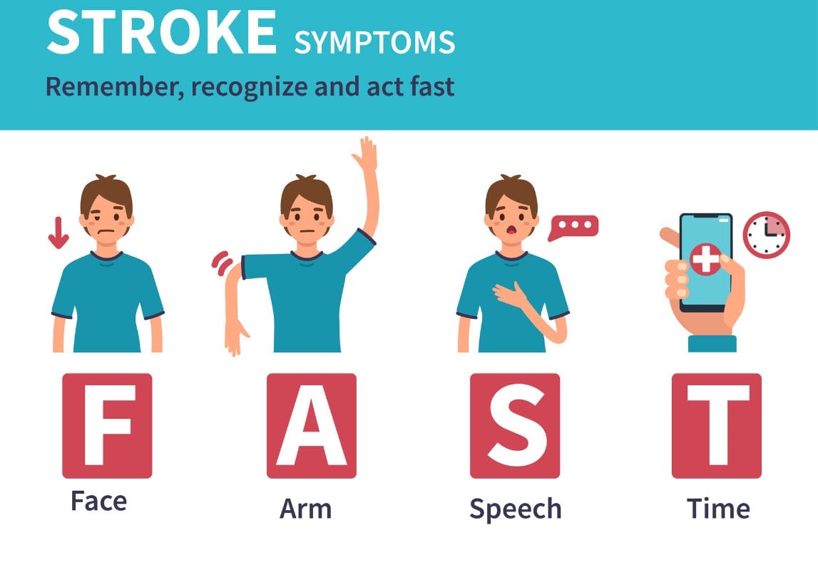  dấu hiệu của bệnh đột quỵ và tai biến nhẹ