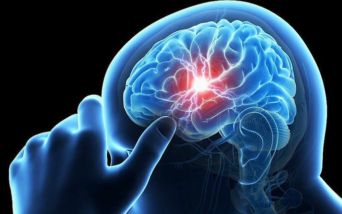 Thiếu máu não là tình trạng rất phổ biến