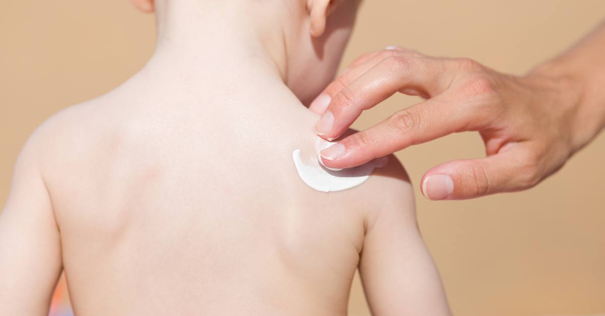 Thoa lớp kem bôi da có tác dụng chống viêm cho vết thương để ngăn ngừa nhiễm trùng