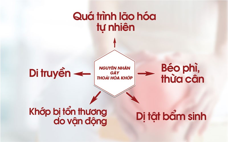 thoái hóa khớp gối 
