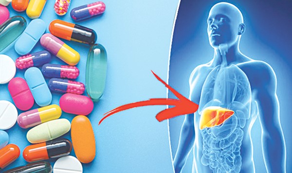 Thoái hóa khớp háng