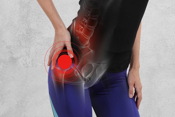 Thoái hóa khớp háng gây đau nhức khó chịu