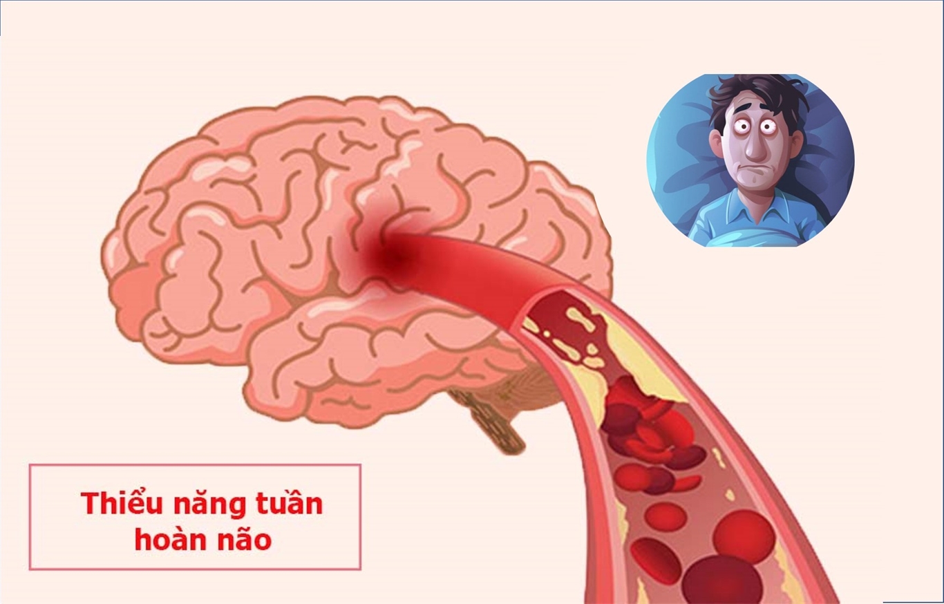 thức giấc nửa đêm không ngủ lại được