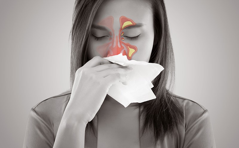 thuốc điều trị viêm xoang cấp