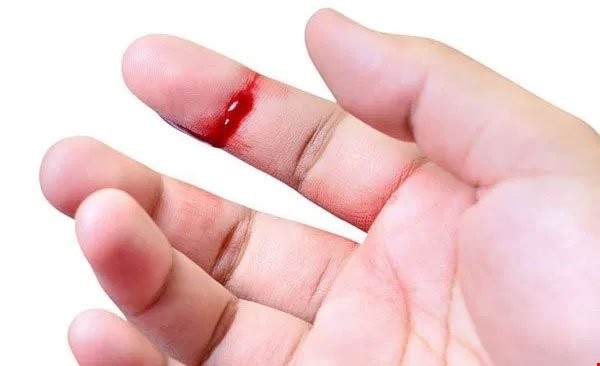 Thuốc hoạt huyết bổ não 