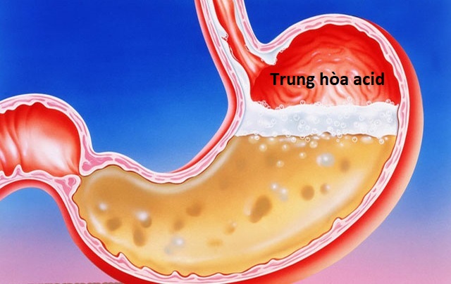 Thuốc trung hòa axit chỉ có tác dụng tức thời, không nên tự sử dụng kéo dài