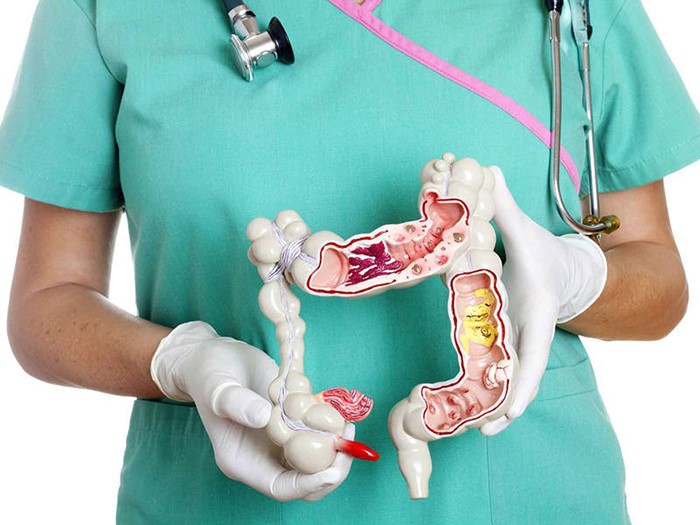 Thụt tháo có thể làm tổn thương ruột, nguy hiểm tính mạng