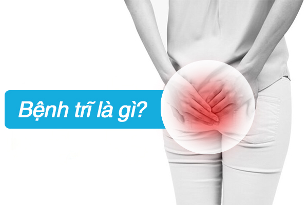 Tìm hiểu bệnh trĩ là gì, các loại bệnh trĩ, triệu chứng và nguyên nhân