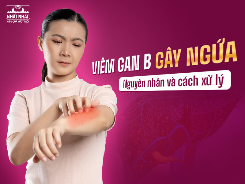 Viêm gan B gây ngứa không chỉ khó chịu mà còn khiến người bệnh lo lắng, ảnh hưởng đến tâm lý. Cần làm gì khi viêm gan B gây ngứa ngáy?