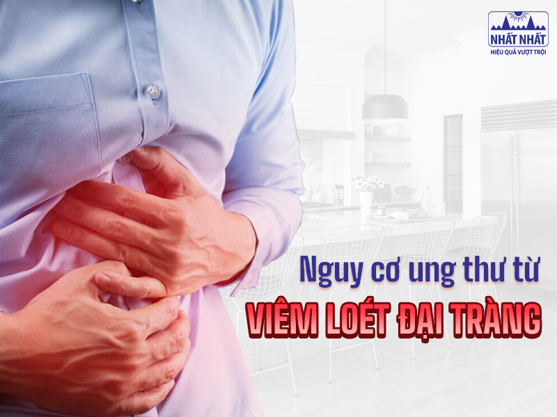 Tìm hiểu dấu hiệu viêm loét đại tràng để điều trị sớm