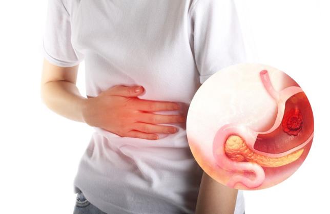 Tìm hiểu loét dạ dày triệu chứng như thế nào