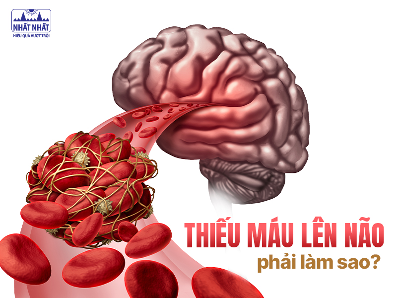 Tìm hiểu thiếu máu não phải làm sao