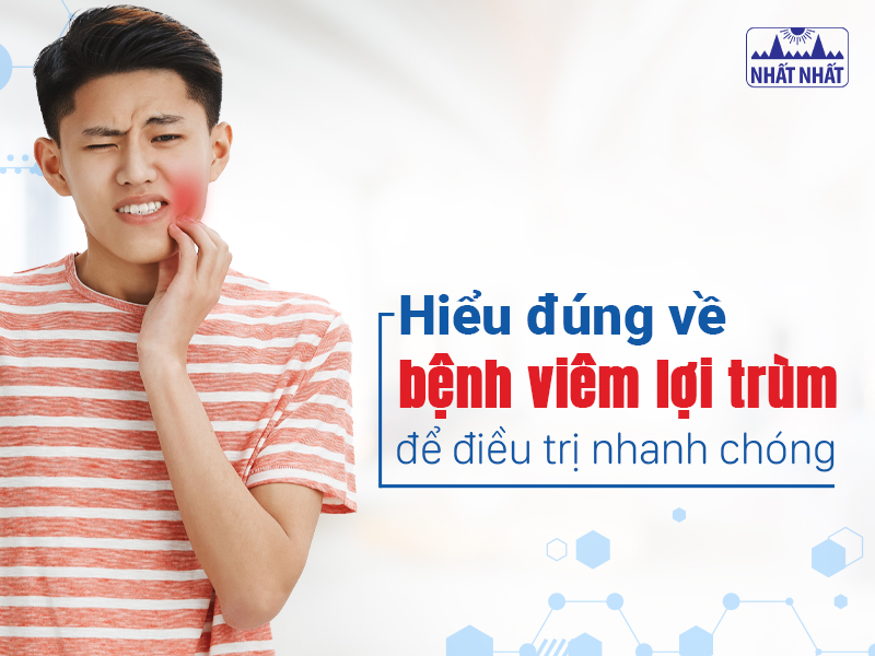 Tìm hiểu về bệnh viêm lợi trùm