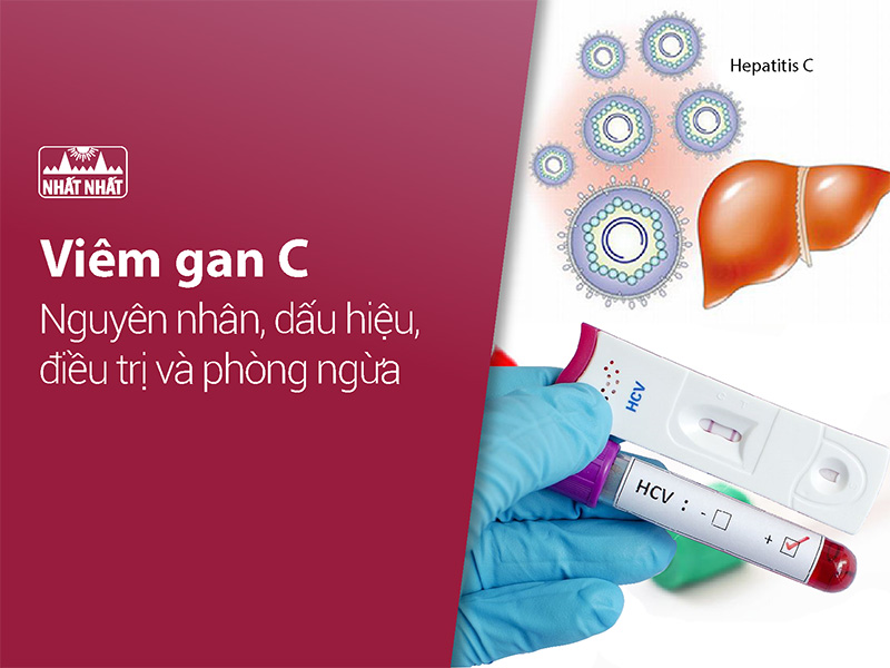 Bệnh viêm gan C
