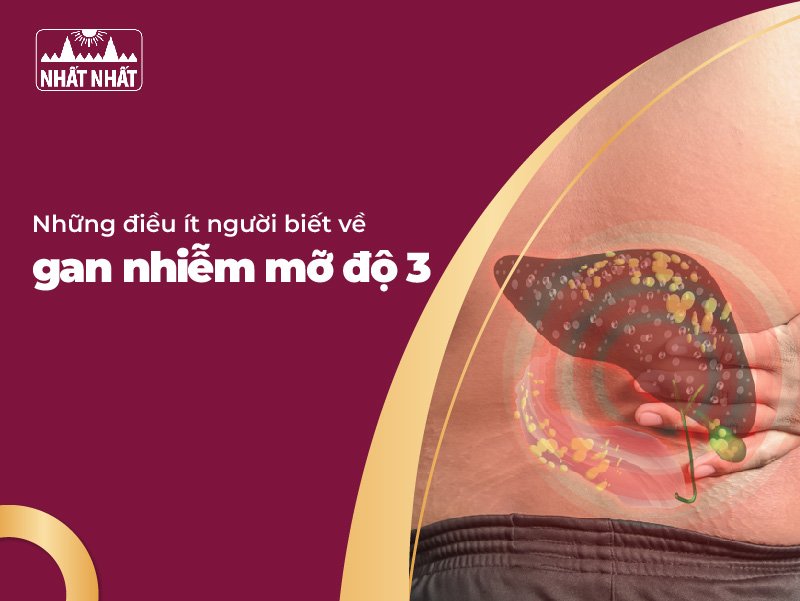 gan nhiễm mỡ độ 3