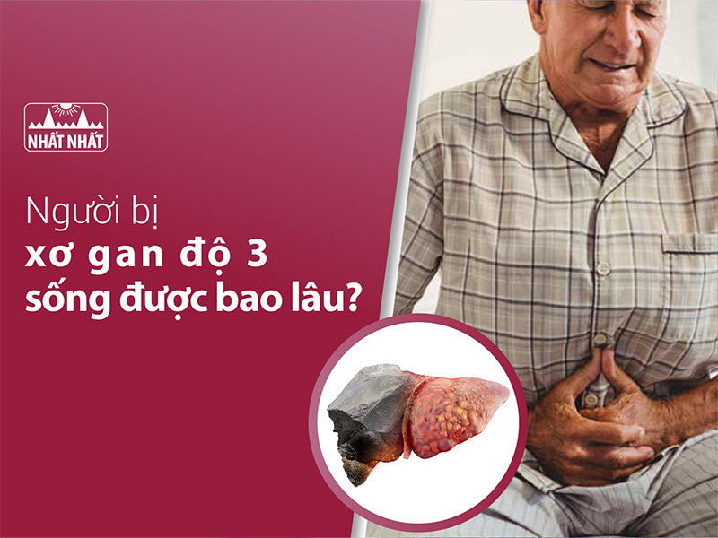 xơ gan độ 3