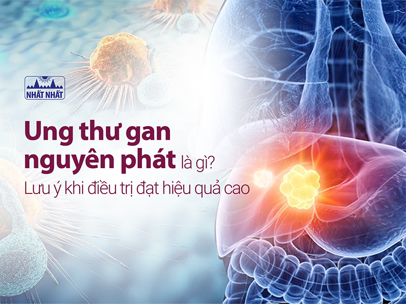  Ung thư gan nguyên phát