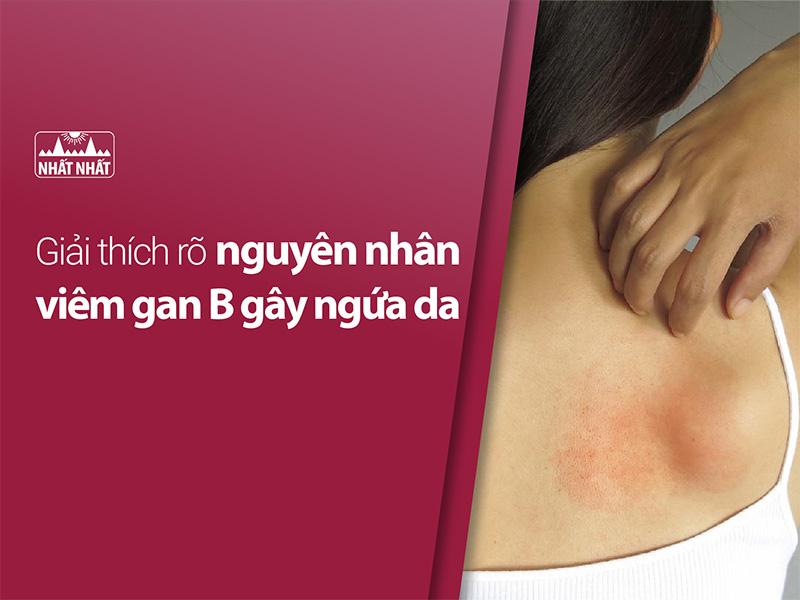 Viêm gan B gây ngứa da