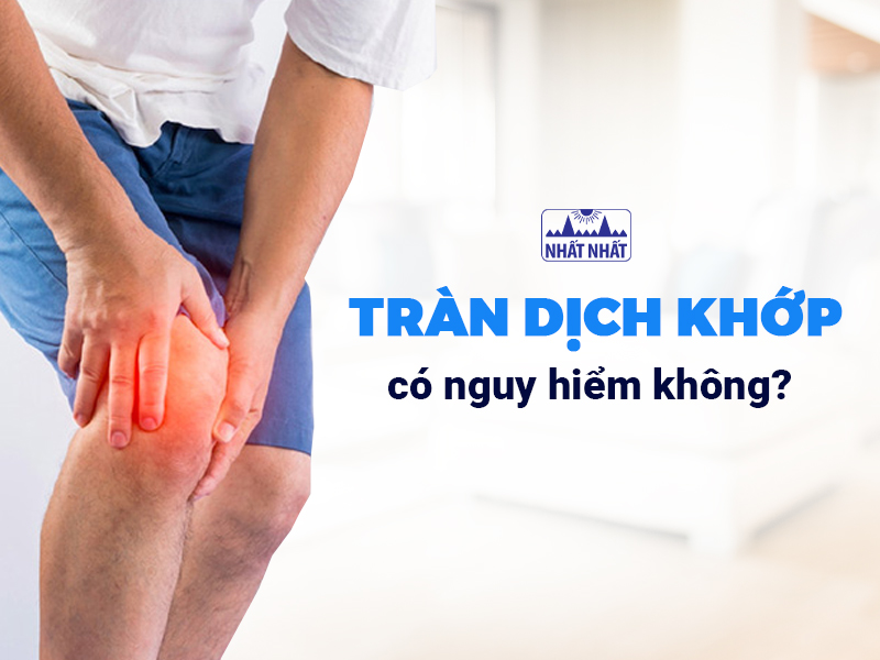 Tràn dịch khớp có thể xảy ra ở bất kỳ khớp nào