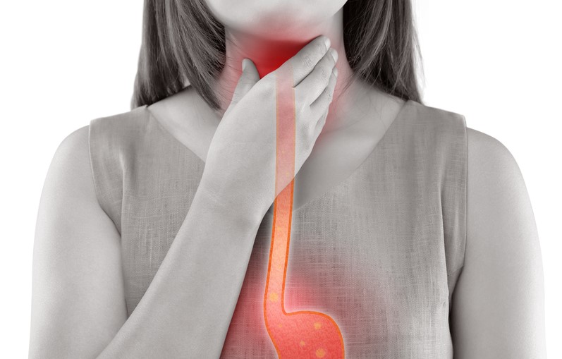  Trào ngược dạ dày lưỡi trắng