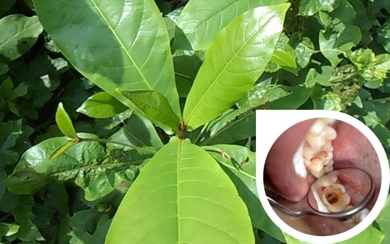 trị nhức răng tại nhà