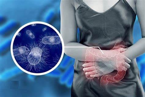 Trong bệnh viêm đại tràng có sự mất cân bằng hệ vi sinh vật đường ruột