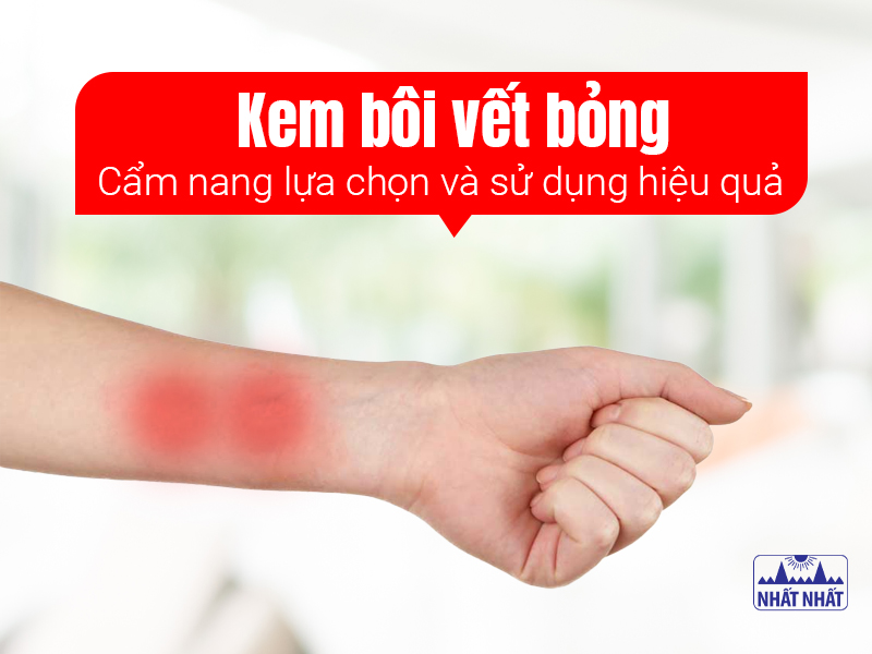 Vết bỏng không được điều trị phù hợp dễ để lại sẹo