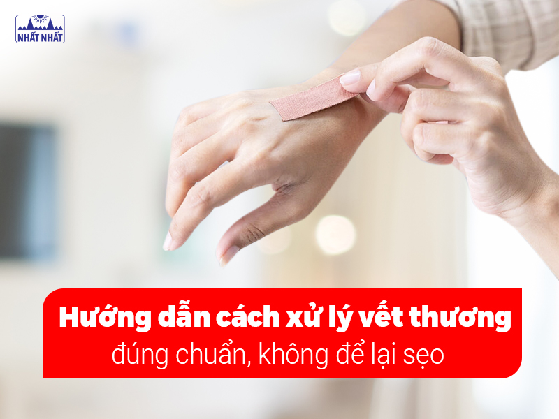 Vết thương được xử lý đúng cách sẽ nhanh lành và không để lại sẹo
