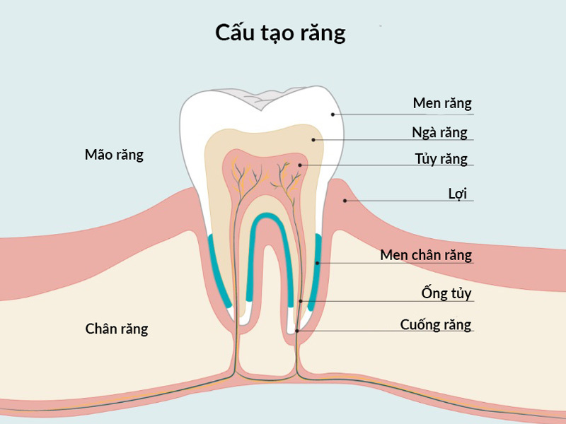 Viêm chân răng hàm có mủ 