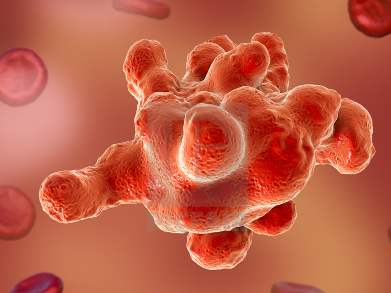 viêm đại tràng cấp