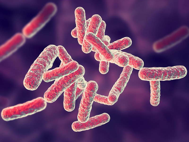 viêm đại tràng cấp