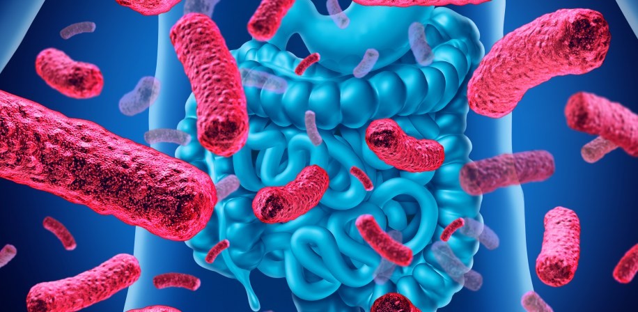 Viêm đại tràng giả mạc 