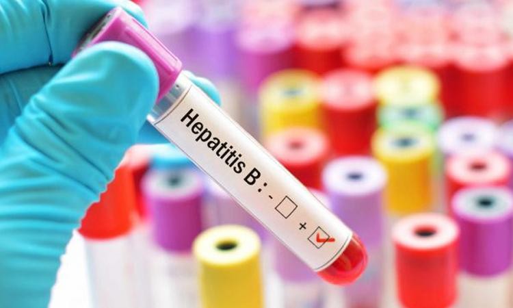 Viêm gan B dương tính 