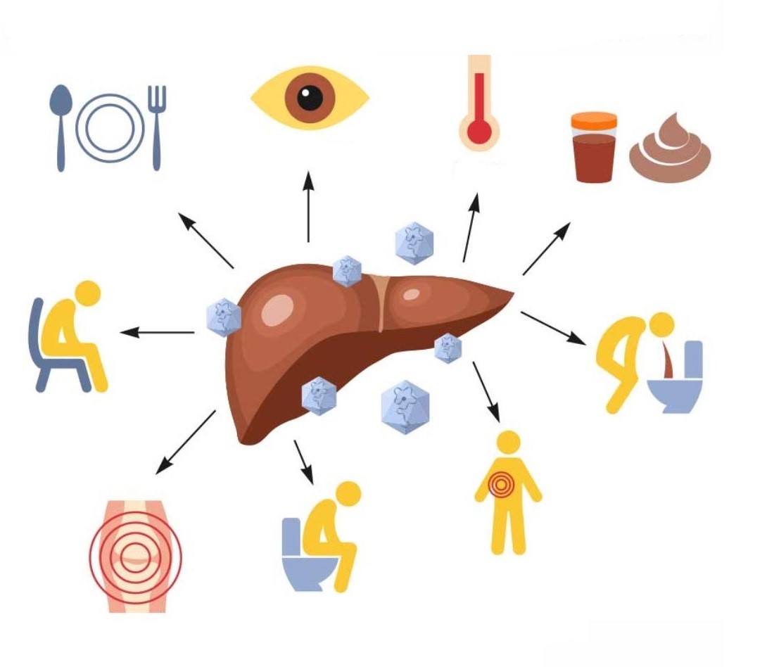 Viêm gan B mạn tính 