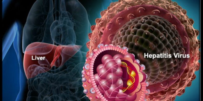 viêm gan mạn tính