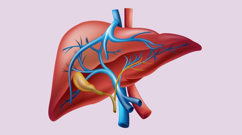 viêm gan mạn tính