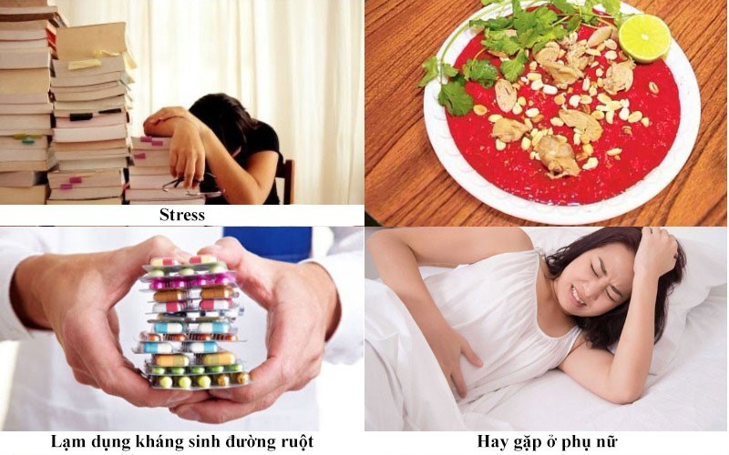 chữa viêm loét đại tràng